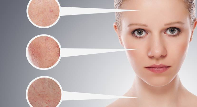 Microneedling mit Dermaroller